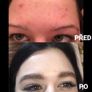 Martina — PŘED a PO 2