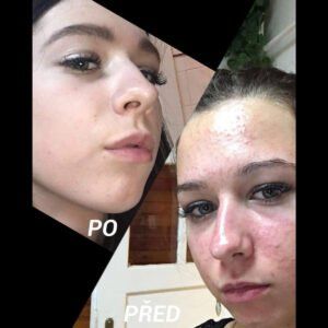 Martina — PŘED a PO 3